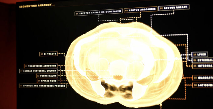 Midjourney Creates Complete-Body Ultrasonic Scanner Utilizing AI Image Generation Technology